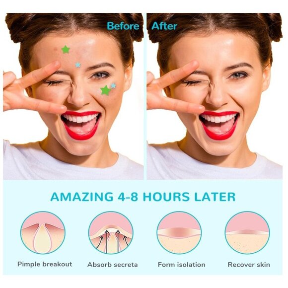 ANAI RUI Acne Patch Pimple Patch, Star-Shaped Pimple Patch, Hydrocolloid Acne St - Picture 5 of 7